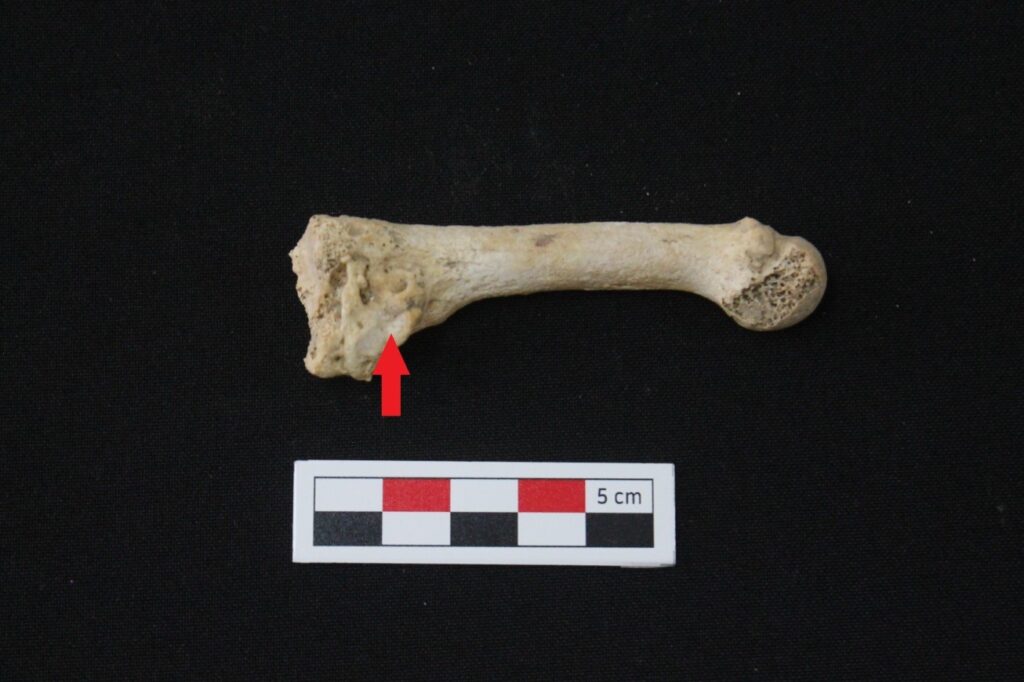 Проведены антропологические и палеопатологические исследования скелетов, найденных на Мынтобинском могильнике.